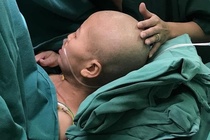 Người mẹ mắc ung thư đã tỉnh, xúc động nhìn ảnh bé Bình An
