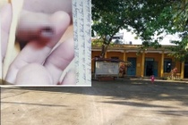 Thực hư thông tin cô giáo vụt chảy máu bộ phận sinh dục bé trai 3 tuổi