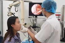 Nguoi phu nu khong an duoc vi viem loet hong, sut 14 kg trong mot nam hinh anh