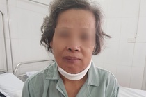 Nguoi phu nu mac ung thu hiem gap hinh anh