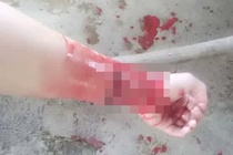 Giới trẻ ngày nay cứ chia tay là đòi tự tử