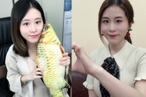 'Thanh an cong so' bi nghi phau thuat tham my hinh anh