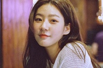 Kim Sae Ron phai boi thuong sau vu tai nan hinh anh