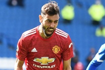 MU danh bai Brighton 3-2 nho ban thang o phut 100 hinh anh