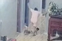 Xac minh clip chau be bi me dap gay xuong dui hinh anh