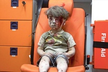 Be trai Syria bi thuong gay chan dong the gioi hinh anh
