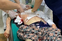 Chong truy sat 3 nguoi gia dinh vo roi tu tu hinh anh
