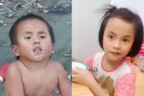 Em be Muong Lat liet 2 chan lon phong phao sau 3 nam duoc nhan nuoi hinh anh