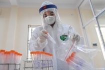 Đại biểu QH: Bộ Y tế có trách nhiệm trong vụ Việt Á thổi giá kit test