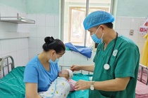 Nâng lún sọ não cho bệnh nhi 2,5 tháng tuổi