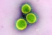 Cùng loại vaccine Covid-19, vì sao tỷ lệ tử vong ở các nước khác nhau?