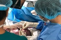 20 y bác sĩ nỗ lực cứu song thai bị bệnh lý tim ngay khi chào đời