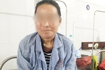 Người phụ nữ bị lở loét mặt do dị ứng kem trộn