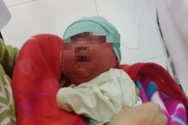 Tre di ung nang sau khi duoc tam bang la cay hinh anh