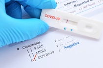 Tiếp xúc F0, khi nào tôi cần xét nghiệm Covid-19?