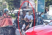 Dieu tra vu mot Tiktoker noi tieng bi chem dut ban tay giua duong hinh anh
