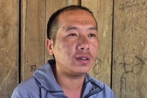 Nguoi dan ke ve nghi ngo bo chet do cho soi can hinh anh