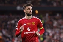 Bruno Fernandes can nhac roi MU hinh anh