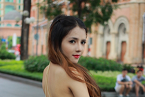                                        Hình ảnh Minh Yến sau phẫu thuật