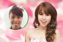 3 yeu to de phau thuat toan dien khuon mat thanh cong hinh anh