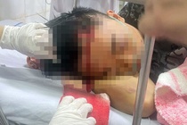 Tam giu 14 nguoi vu 2 nhom trai lang o Hai Phong hon chien hinh anh