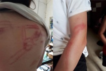 Nguoi cha bi to bao hanh hai con ruot noi gi? hinh anh