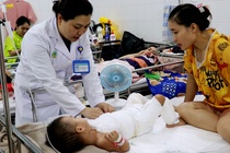 Phong nuoc soi, be 2 tuoi mat 60% da co the hinh anh