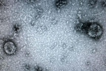 Virus corona có thể tồn tại bao lâu trên tiền?