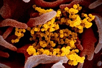 Vì sao virus SARS-CoV-2 có nhiều chủng và biến thể?