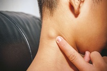Khi nào nổi hạch là dấu hiệu của bệnh ung thư?
