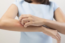 Căn bệnh khiến người phụ nữ ở Mỹ liên tục gãi ngứa