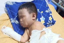 2 trẻ em bị bỏng khi nhóm côn đồ ném bom xăng vào nhà