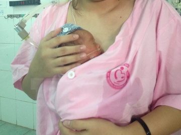 Cuu 2 be sinh non nang duoi 800 gram kem suy ho hap nang hinh anh