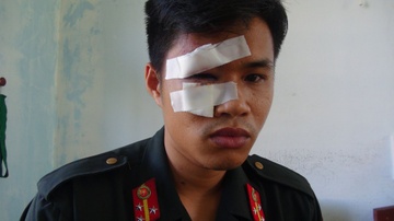 Tam giu 9 nguoi gay roi, vay canh sat co dong hinh anh