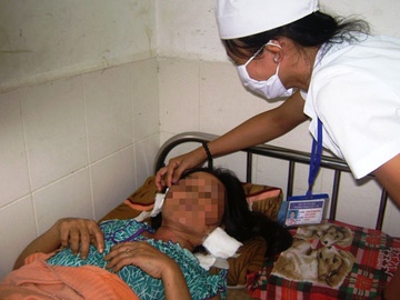 Loi ke cua nguoi bi rach 15 nhat dao len mat hinh anh