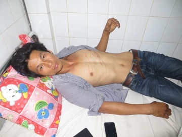 Dan to bi danh nhap vien, cong an noi 'tu rach' vao co the hinh anh