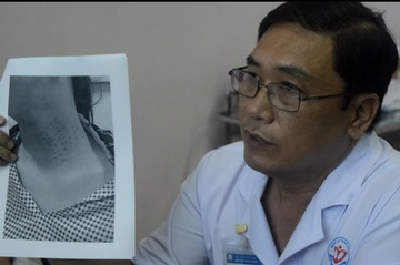 Ruoc hoa khi tiem my pham boi ngoai da vao co the hinh anh