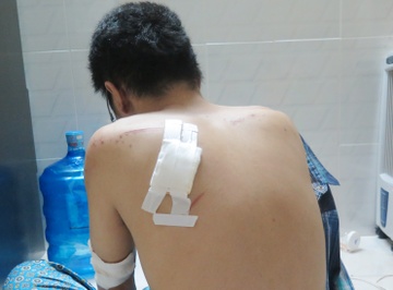 Canh sat dieu tra bang cuop xe tay ga o Sai Gon hinh anh