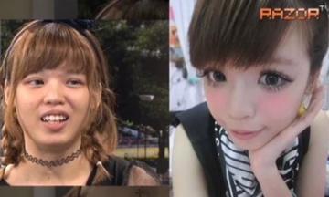 Mat moc cua cac hot girl chau A hinh anh
