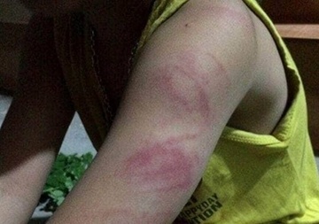 Hoc sinh lop 1 bi danh bam tim tay vi khong doc thong viet thao hinh anh