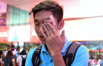Trong Dai che mi mat bi rach khi vao TP.HCM cung U22 Viet Nam hinh anh