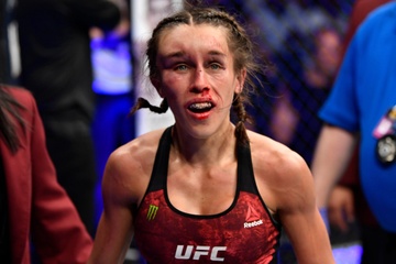Ly do nu vo si UFC danh tiep du bi bien dang mat hinh anh
