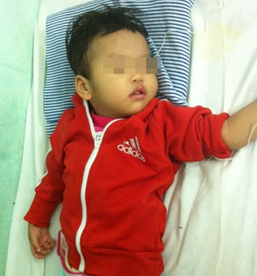 Be gai 3 tuoi mac benh roi loan chuyen hoa bam sinh hinh anh