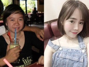 Co gai mui tet lot xac sau 5 lan phau thuat tham my hinh anh
