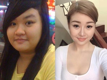 Nhan sac xinh dep cua co gai sau khi nang mui, giam can hinh anh