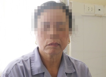 Nguoi phu nu bi meo mieng sau khi ngu day hinh anh