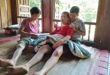 Mac benh hiem, thieu nu khon kho song canh thuc vat hinh anh