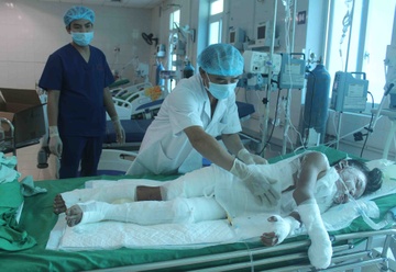 Can trong tai nan thuong tich o tre khi nghi he hinh anh