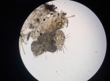 Soc vi ran lam to tren mi mat nguoi phu nu hinh anh