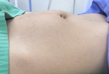 Be gai 15 tuoi bat ngo mac loai ung thu sinh duc hiem gap hinh anh